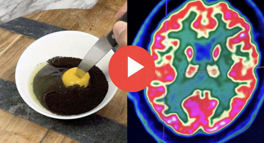 natural remedy for memory loss
